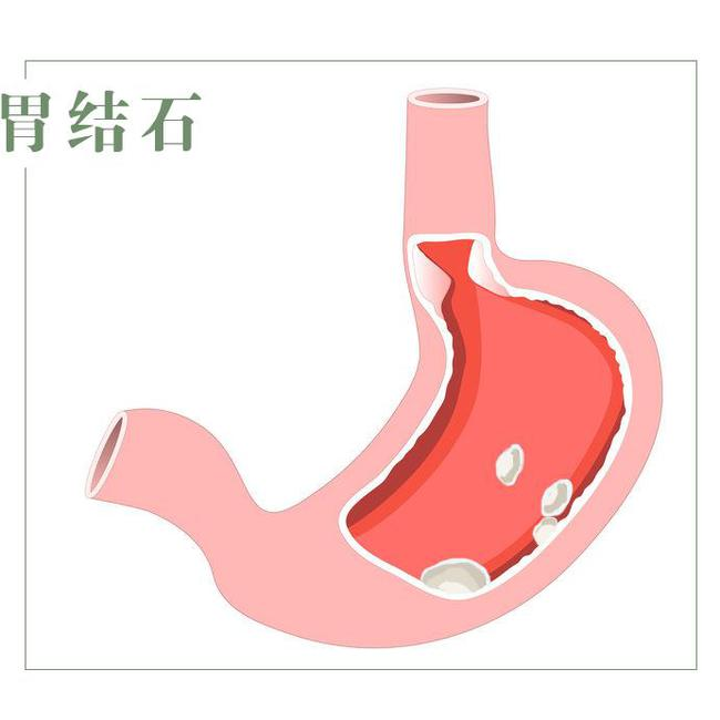 4f97e7156d29d9113ffd458c991fd37.png 4f97e7156d29d9113ffd458c991fd37.png