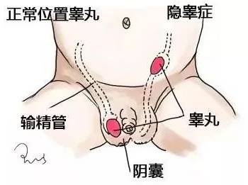 fb17adb7b6046da643181e392acd570.png