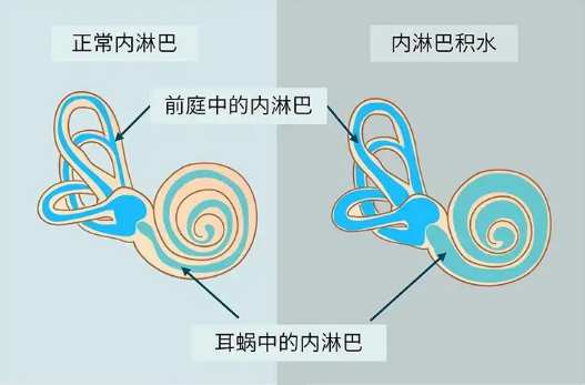 640 (1).png