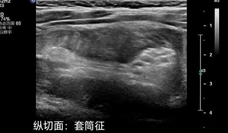 nEO_IMG_640 (5).jpg